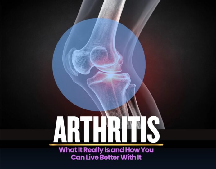 What It Really Is and How You Can Live Better With It